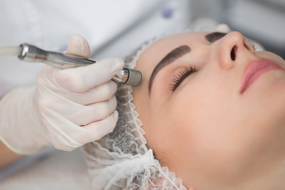 mikrodermabrasion